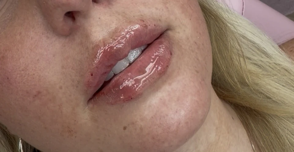 Three-quarter profile showing a plush glossy pout