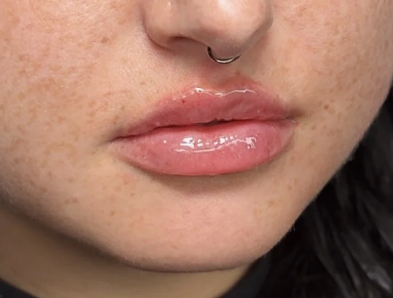 Soft mini pout with gentle volume and gloss